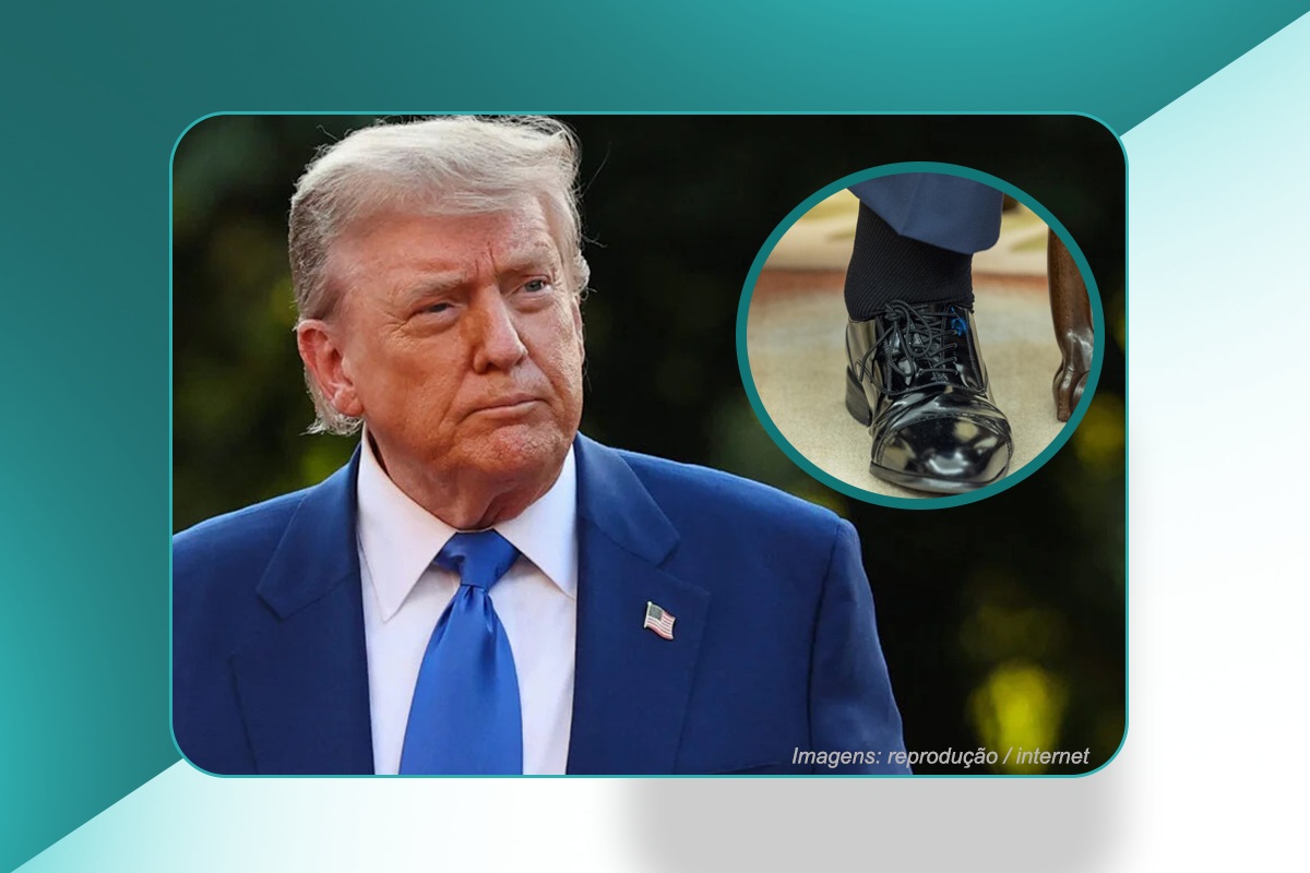 Insuficiência Venosa Crônica - Donald Trump