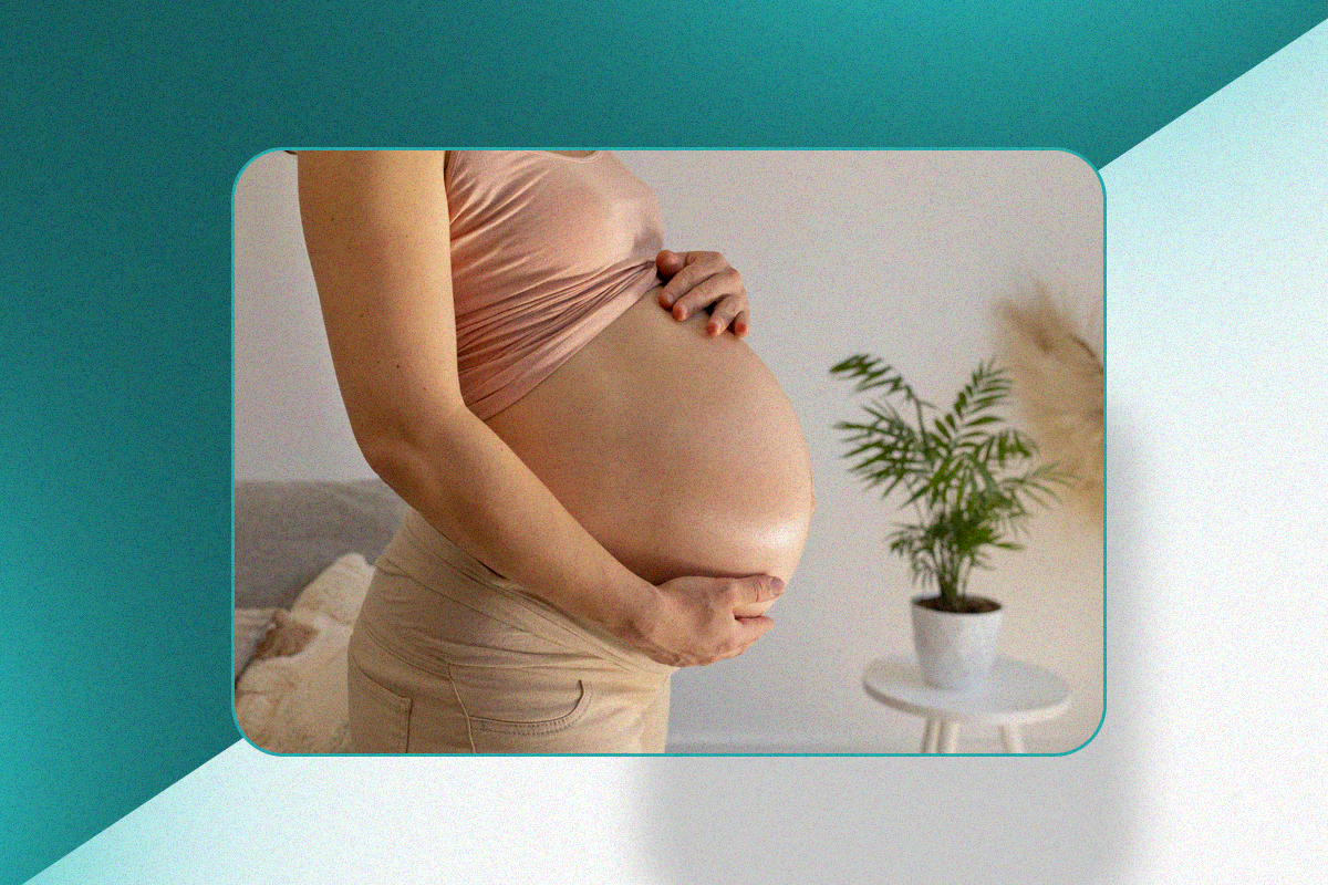 Acretismo Placentário