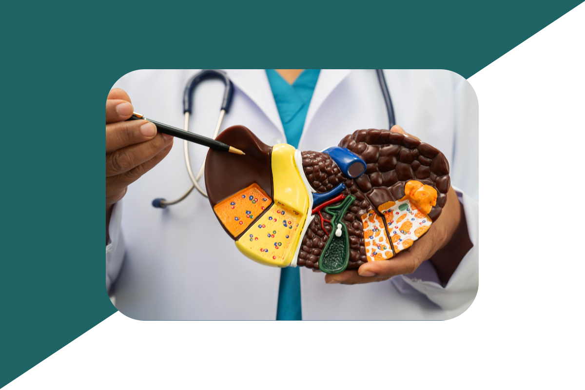 quimioembolização; Tumor do fígado.