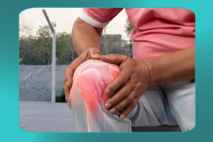 embolização; artrose de joelho