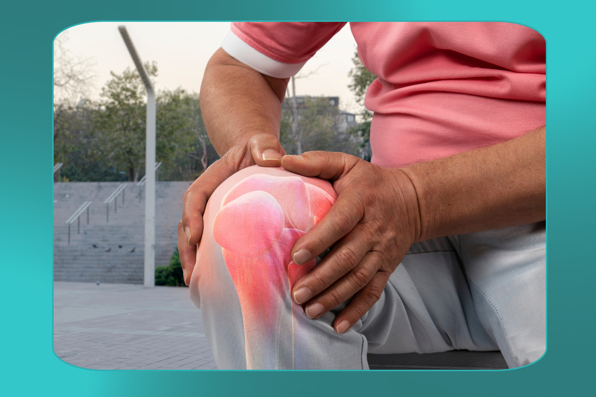 embolização; artrose de joelho