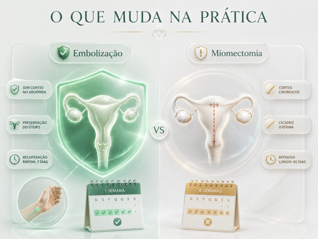 embolização de miomas ou miomectomia
